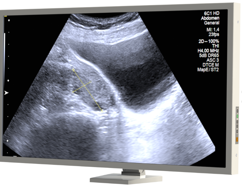 32'' Cerrahi ve Ameliyathane Monitörü