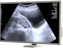 32'' Cerrahi ve Ameliyathane Monitörü