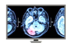 21.3'' Radyoloji Monitörü