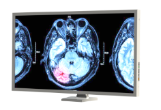24'' Radyoloji Monitörü