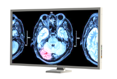 29.8'' Radyoloji Monitörü